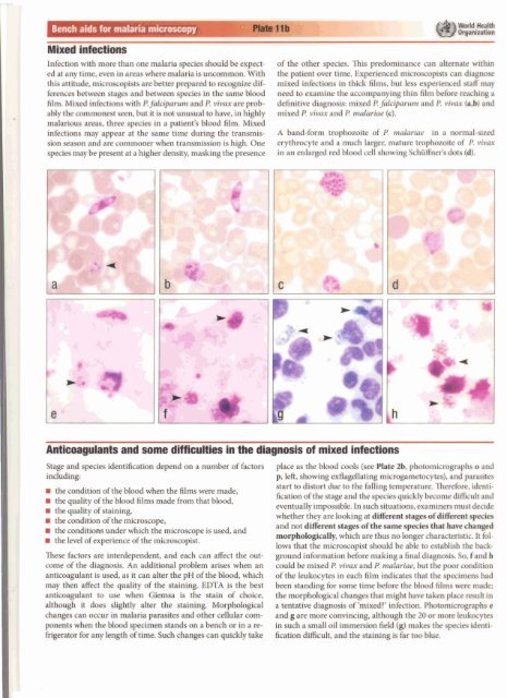 I Bench aids for malaria microscopy