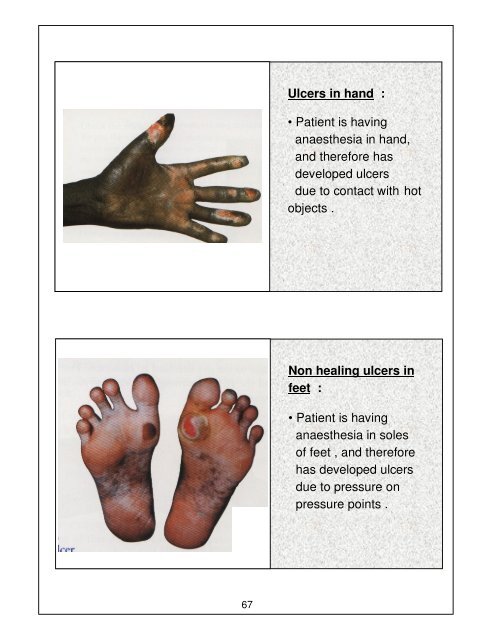 Leprosy Training Module for Medical Officers