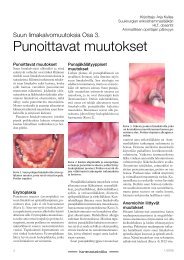 Osa 3. Punoittavat muutokset