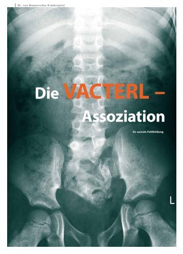 Die VAcTERl – Assoziation - Hauner Journal