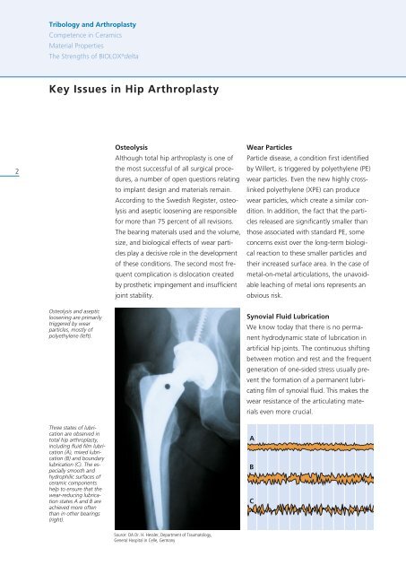 BIOLOX - Nanocomposite for Arthoplasty