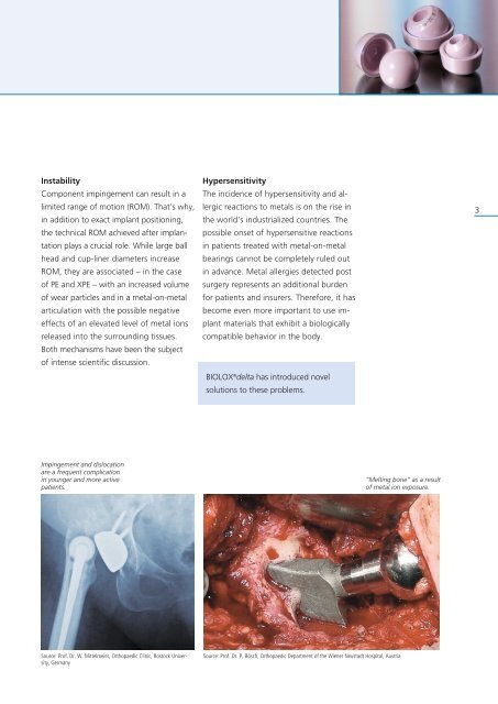 BIOLOX - Nanocomposite for Arthoplasty