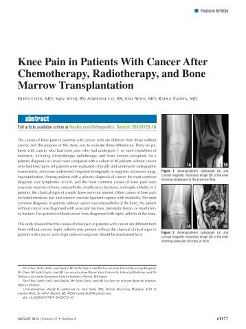 Knee Pain in Patients With Cancer After Chemotherapy ... - Healio