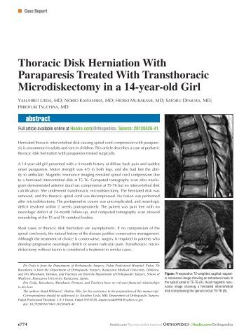 Thoracic Disk Herniation With Paraparesis Treated With ... - Healio