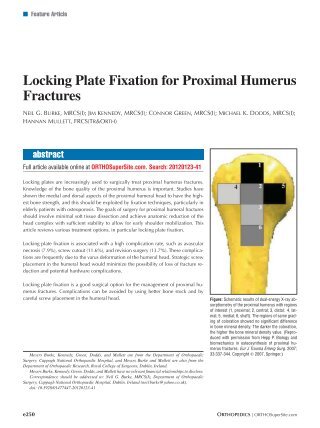 Locking Plate Fixation for Proximal Humerus Fractures - Healio