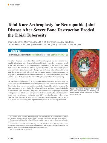 Total Knee Arthroplasty for Neuropathic Joint Disease After ... - Healio