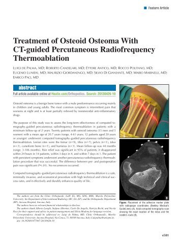 Treatment of Osteoid Osteoma With CT-guided ... - Healio