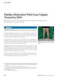 Patellar Dislocation With Genu Valgum Treated by DFO - Healio