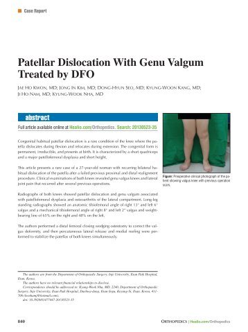 Patellar Dislocation With Genu Valgum Treated by DFO - Healio