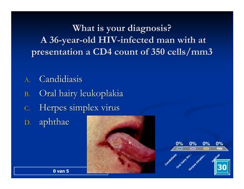 Clinical Manifestations & Opportunistic Infections - Health[e ...