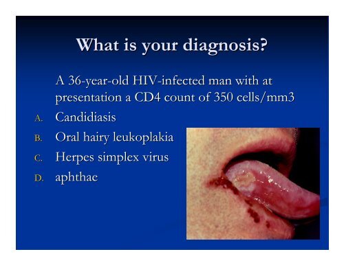 Clinical Manifestations & Opportunistic Infections - Health[e ...