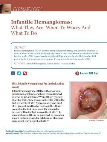 Infantile Hemangiomas - HealthPlexus.net