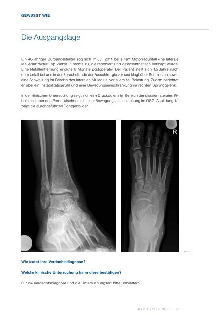 UPDATE - Uniklinik Balgrist