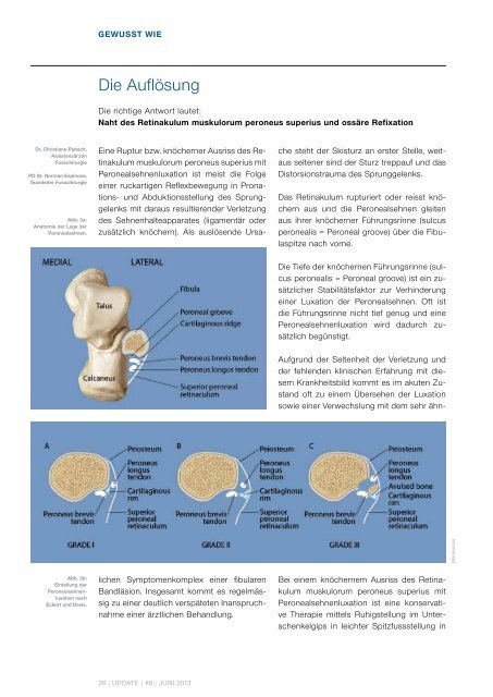 UPDATE - Uniklinik Balgrist