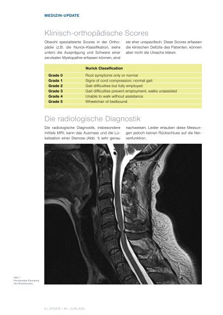 UPDATE - Uniklinik Balgrist