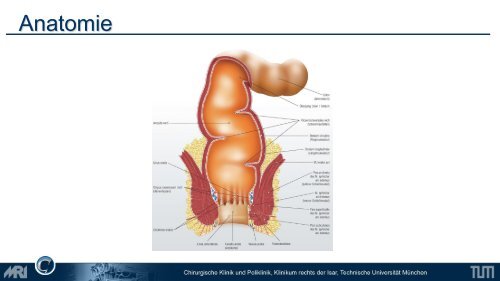 Lower GI - Chirurgie