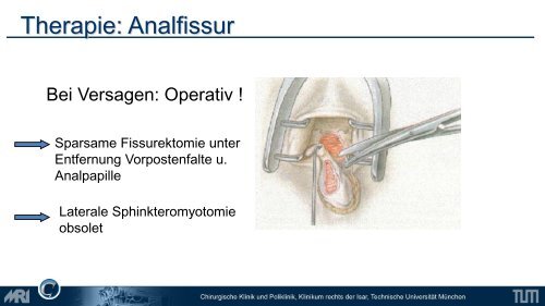 Lower GI - Chirurgie