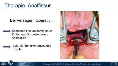 Lower GI - Chirurgie