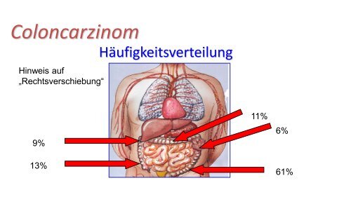 Lower GI - Chirurgie