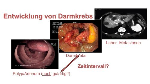 Lower GI - Chirurgie