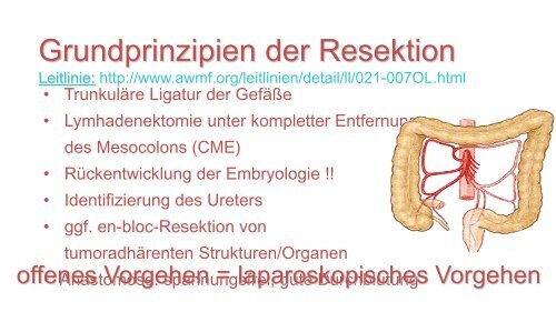 Lower GI - Chirurgie