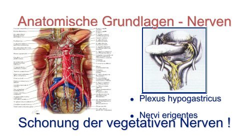 Lower GI - Chirurgie