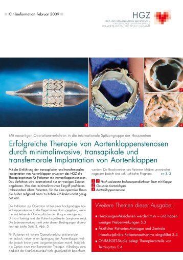 "Minimalinvasive Therapie von Aortenklappenstenosen" (PDF ... - Herz