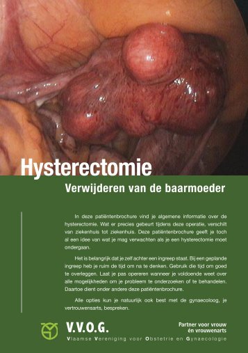 Hysterectomie (verwijderen van de baarmoeder)