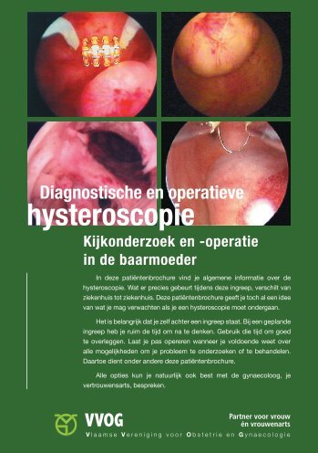 Diagnostische en operatieve hysteroscopie