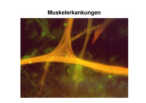 Muskelerkankungen