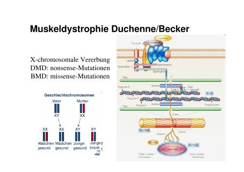 Muskelerkankungen