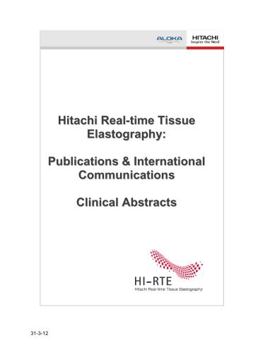 Hitachi Real-time Tissue Elastography for Women's Health