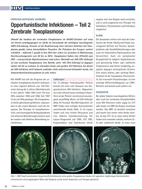 Opportunistische Infektionen â Teil 2 Zerebrale ... - HIV & More