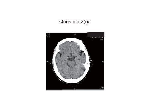 OSCE (Answers)