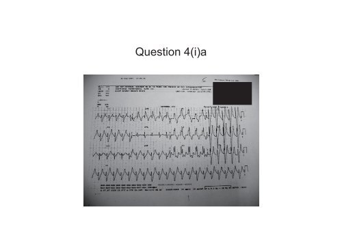 OSCE (Answers)