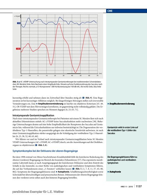 Die Ableitung zervikaler und okulärer vestibulär ... - HNO Schwindel