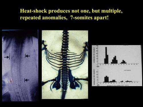 Development of the vertebral column - UCL