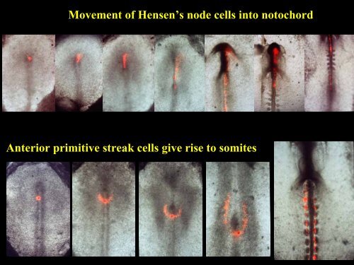 Development of the vertebral column - UCL