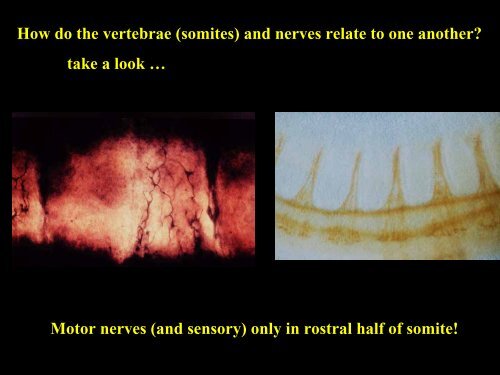 Development of the vertebral column - UCL