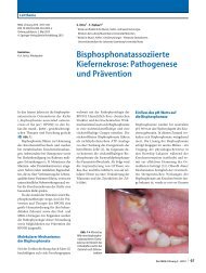 Bisphosphonatassoziierte Kiefernekrose Pathogenese und PrÃ¤vention