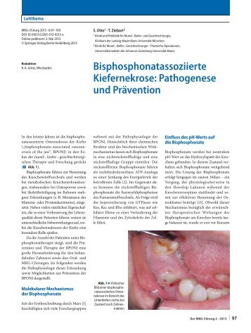 Bisphosphonatassoziierte Kiefernekrose Pathogenese und PrÃ¤vention