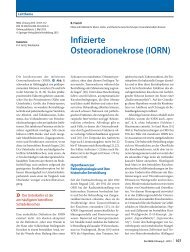 Infizierte Osteoradionekrose - Dr.-Horst-Schmidt-Kliniken Wiesbaden