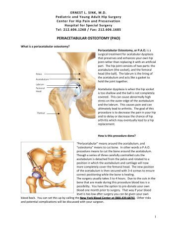 What is a periacetabular osteotomy?