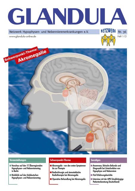 A Akromegalie - Netzwerk Hypophysen- und ...