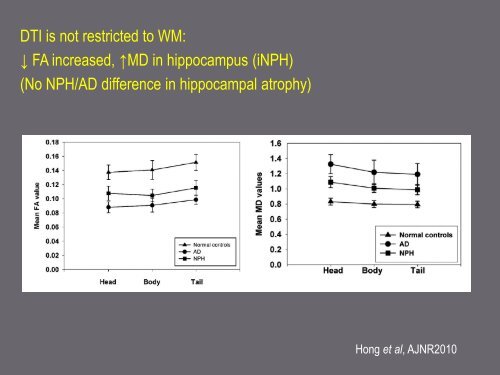 Mechanisms in hydrocephalus revealed by neuroimaging