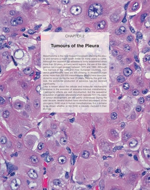 mesothelioma and radiation exposure