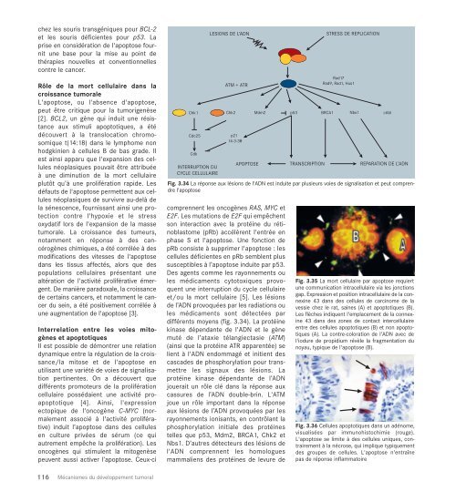 Le cancer, un fardeau mondial - IARC