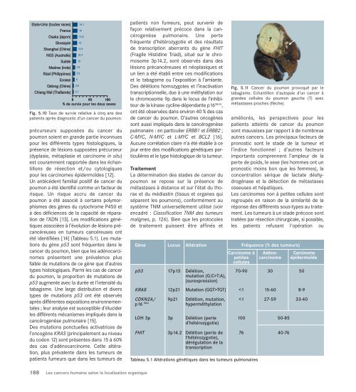 Le cancer, un fardeau mondial - IARC