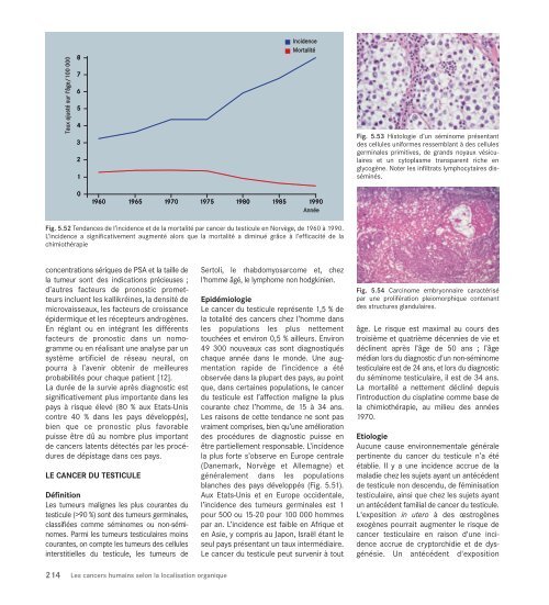 Le cancer, un fardeau mondial - IARC