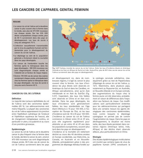 Le cancer, un fardeau mondial - IARC